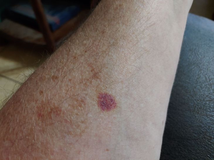 0720201153b_compress77